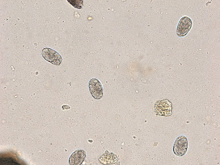 Hookworm Eggs detected on a fecal floatation test